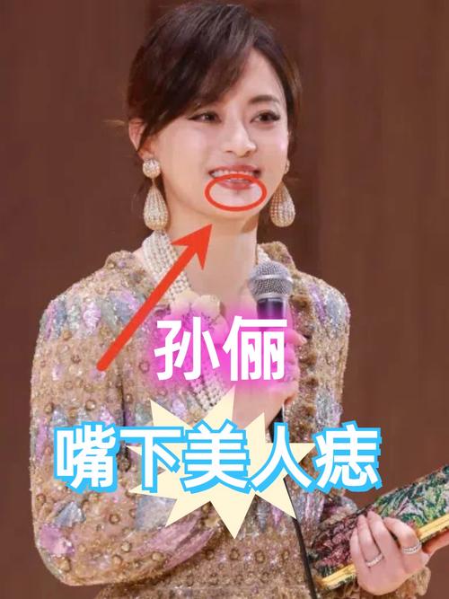 新澳今日开奖结果:孙俪唇下痣没了
